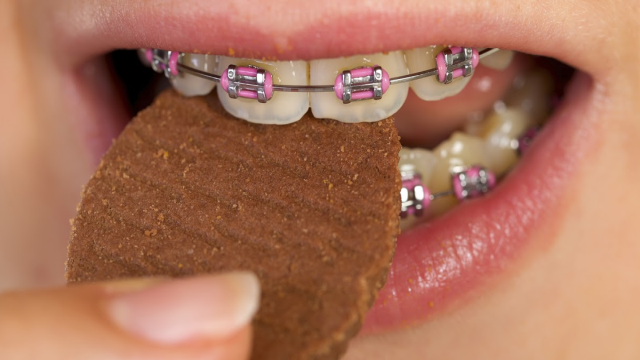 7 Makanan Penyebab Gigi Berlubang yang Harus Kamu Kurangi Sebelum Terlambat